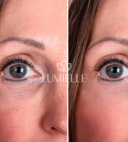 LUMIELLE-PRV-5.webp