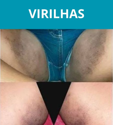AXILAS (3)